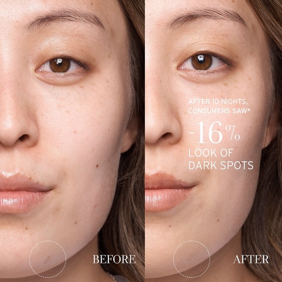 🪷 Fresh Lotus Youth Preserve Resurfacing Dream Serum - Picture 5 of 8